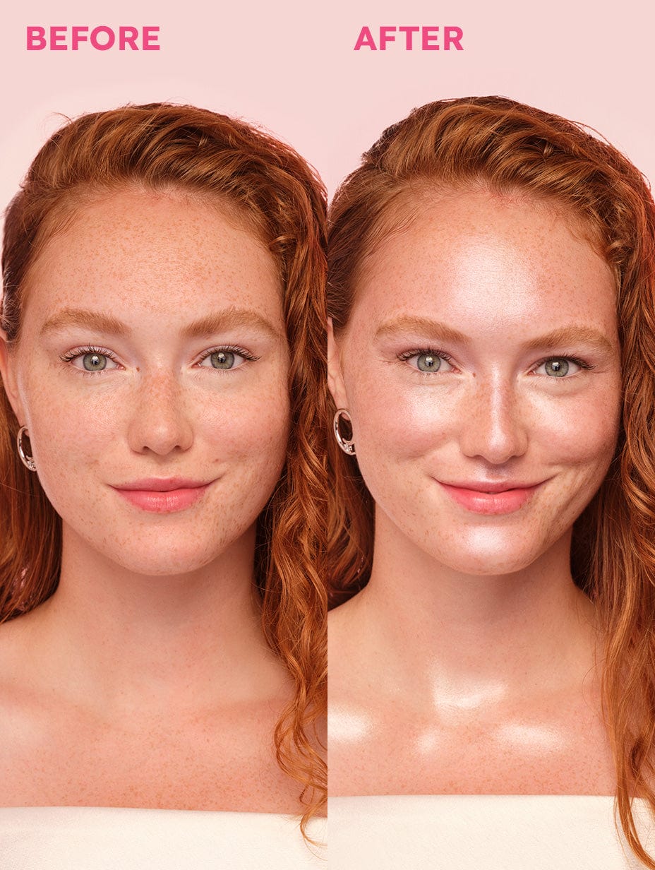 LoveBeam® Perfector