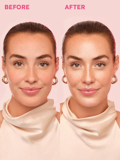 LoveBeam® Perfector