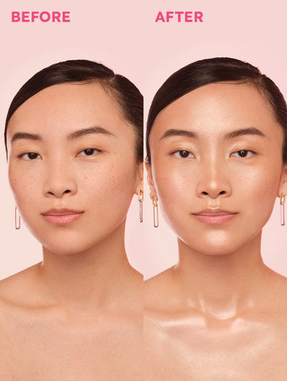 LoveBeam® Perfector